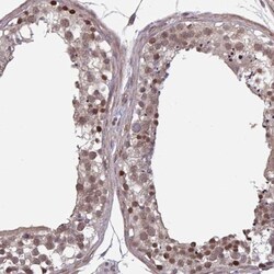 Karyopherin (importin) beta 3 Antibody, Novus Biologicals 0.1mL; Unlabeled:Antibodies,